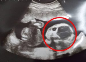 初めての胎動！妊娠中期Ⅱ（１９～２４週）｜アラサー通訳者の妊娠ログ⑤