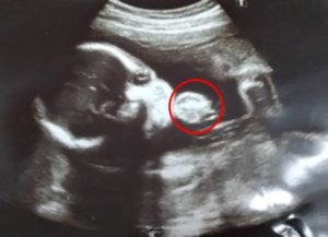 初めての胎動！妊娠中期Ⅱ（１９～２４週）｜アラサー通訳者の妊娠ログ⑤